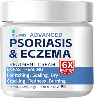 Best eczema cream adult